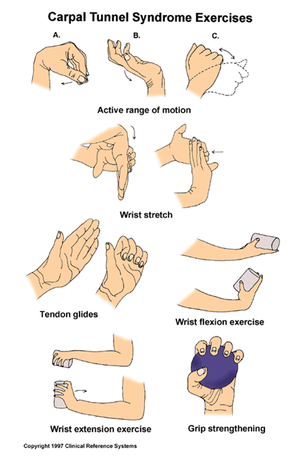 Exercise Advice: Carpal Tunnel Syndrome The Chartered Society Of